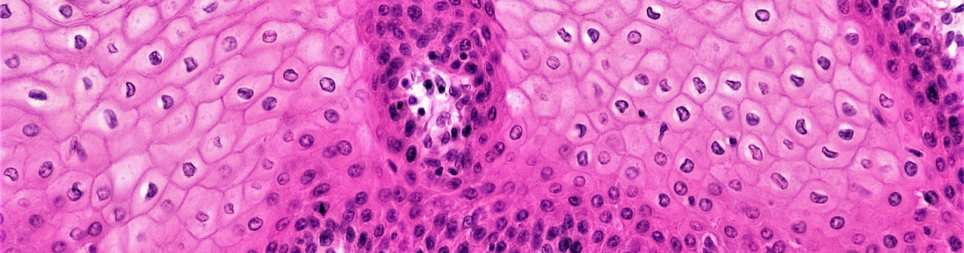260115_ Endometriosis_bioscience-image-library-by-fayette-reynolds-GAGetw-WkHs-unsplash.jpg